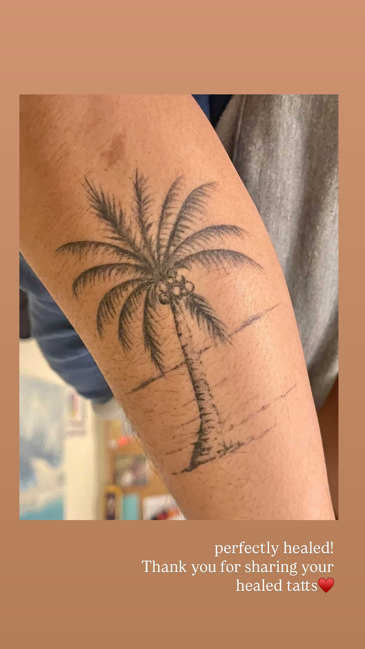 Palm tree on a beach, healed fine line tattoo