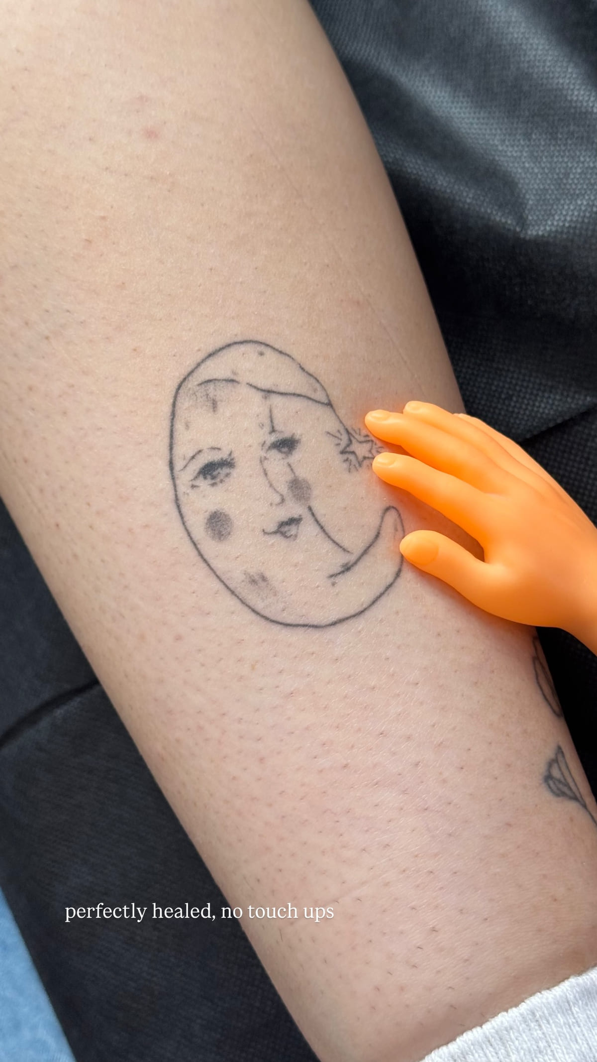 Moon with a face and a nightcap, a year on, healed fine line tattoo, healed