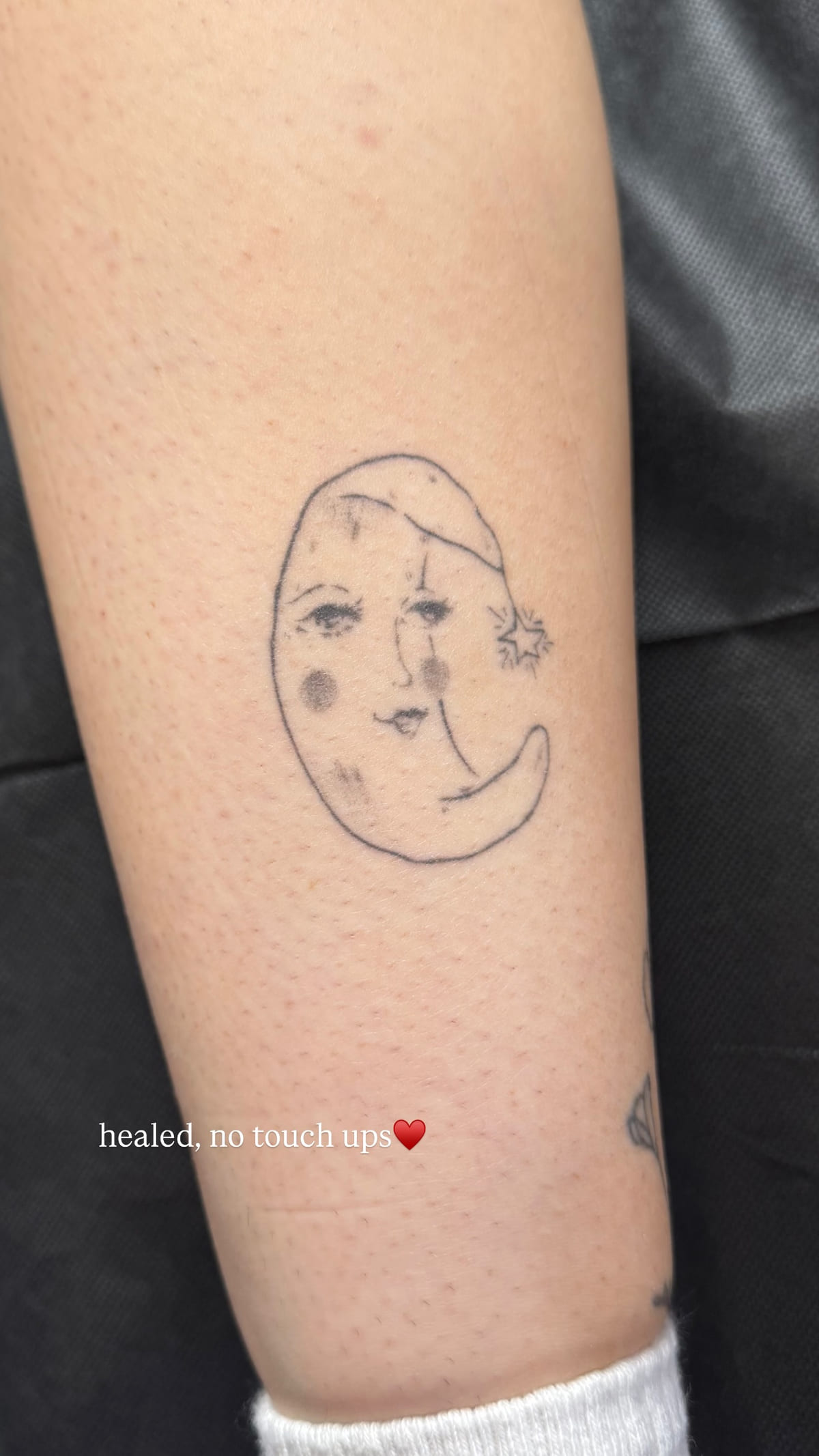 Moon with a face and a nightcap on a calf, healed fine line tattoo, healed